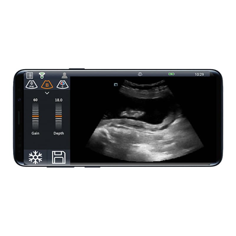 Youkey D8 Mobile Ultrasound Machine color | with linear transducer (L11-4Ks)