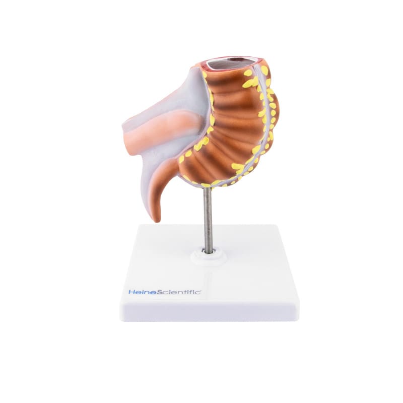 Appendix Model