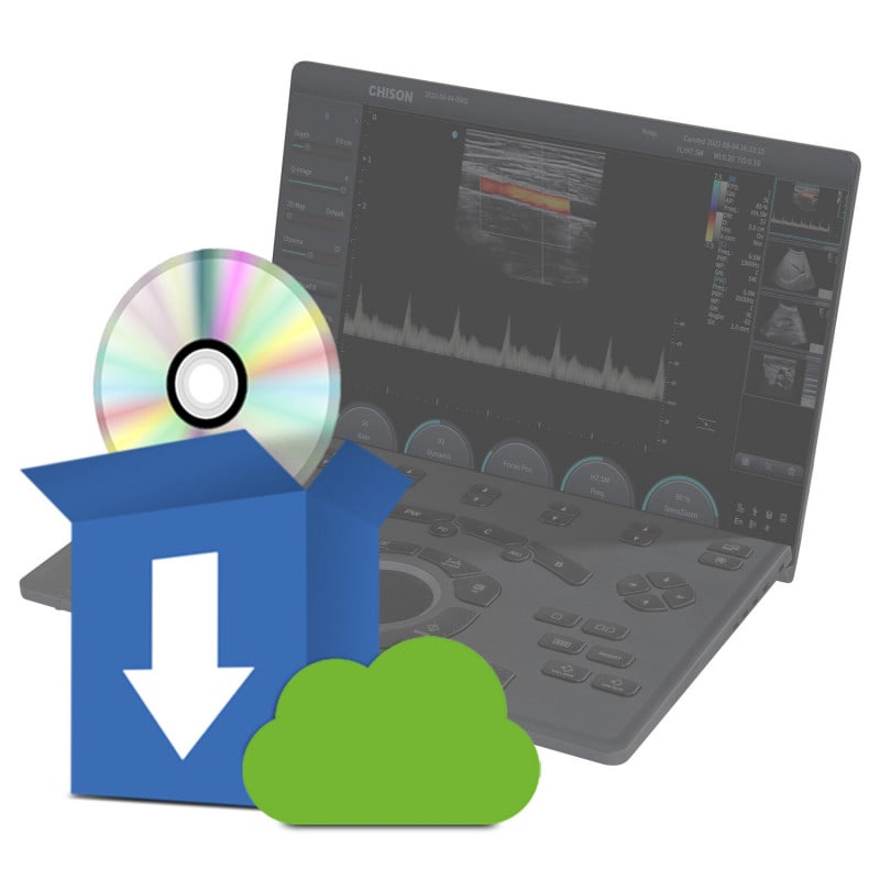 SonoAir 70 Intelligent Doppler Option