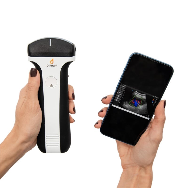 D-Heart Handheld Ultrasound Scanner convex | without tablet