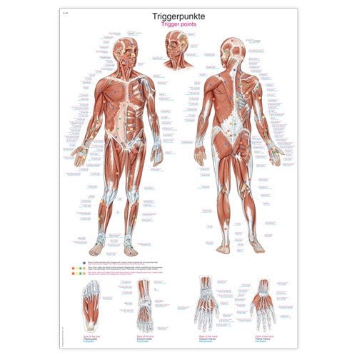 Triggerpoints Wall Chart