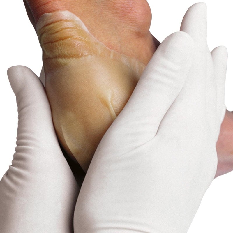 Hydrocoll Hydrocolloid Dressing 5 x 5cm