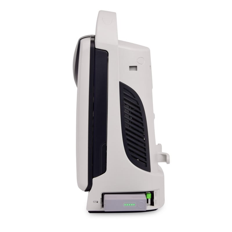 Mindray DP 30 without battery | convex transducer (35C50EA)