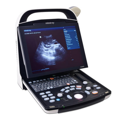 Mindray DP 10 with battery | convex transducer