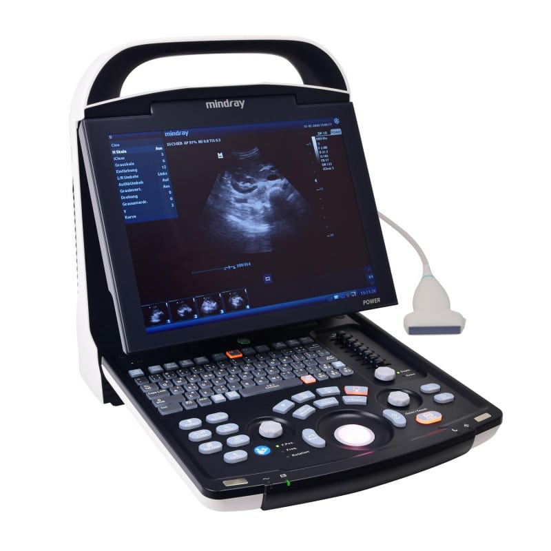 Mindray DP 30 with battery | linear transducer  (75L38EA)
