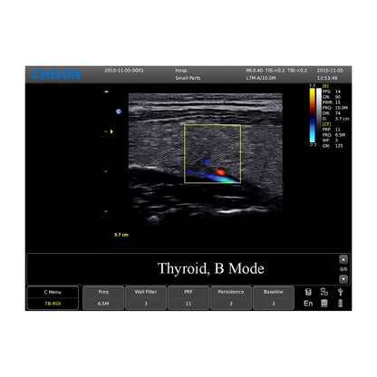 CHISON ECO5 incl. Ultrasound Trolley with linear probe