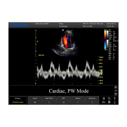 CHISON ECO5 Ultrasound Machine with Color Doppler + linear transducer