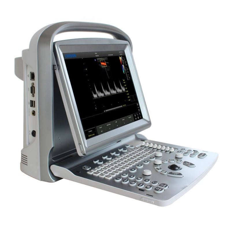 CHISON ECO5 Ultrasound Machine with Color Doppler + linear transducer