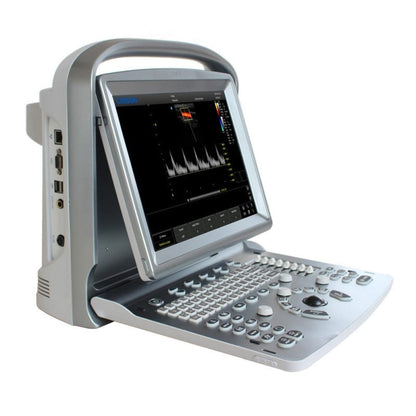 CHISON ECO5 Ultrasound Machine with Color Doppler + convex transducer