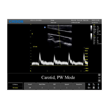 CHISON ECO3 incl. Ultrasound Trolley with convex probe