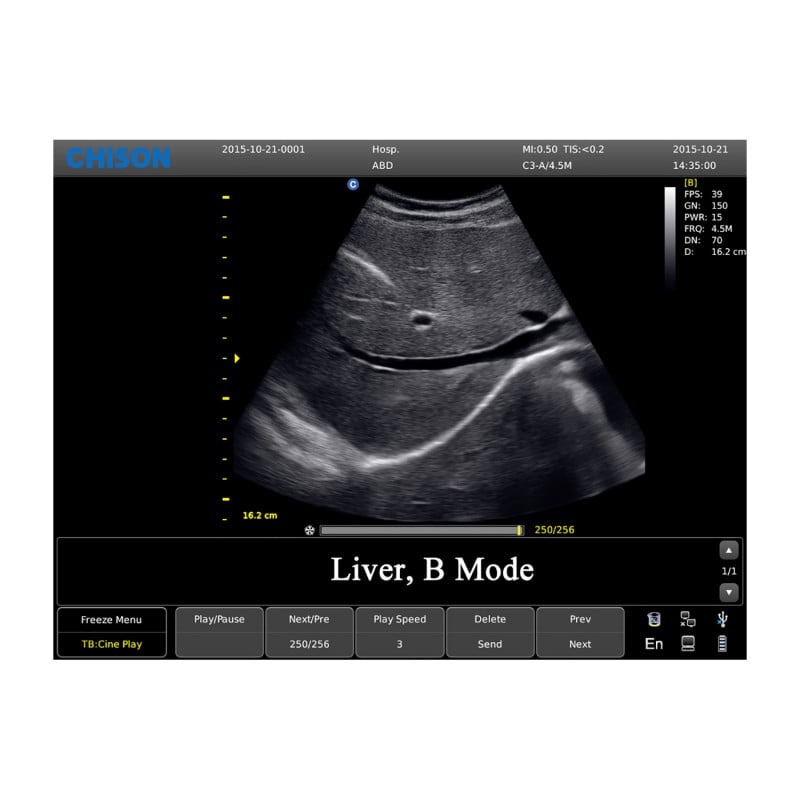CHISON ECO3 incl. Ultrasound Trolley with linear probe
