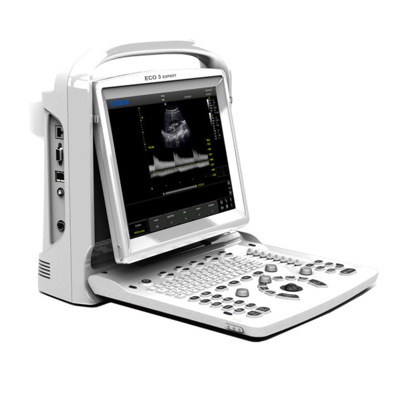 CHISON ECO3 Expert Ultrasound Machine with linear transducer (L7M-A)