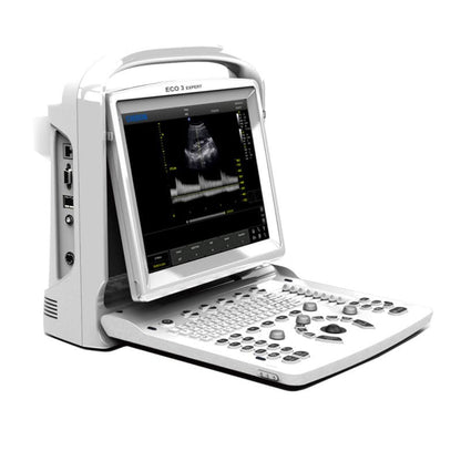CHISON ECO3 incl. Ultrasound Trolley with convex probe