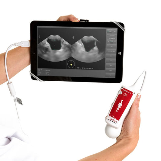 VitaScan v.2 Bladder Scanner System (incl. Transducer, Tablet)