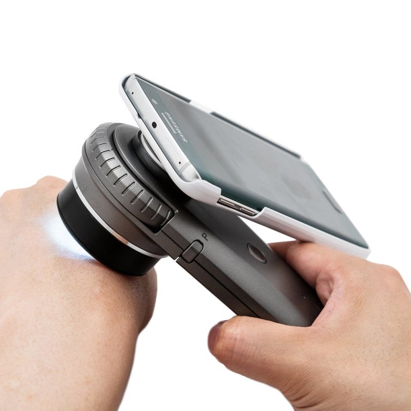 DermoScan Smartphone Adapter for iPhone 8, 8S