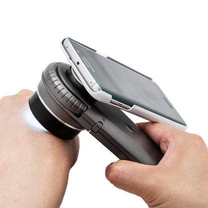 DermoScan Smartphone Adapter for Samsung Galaxy Note 5