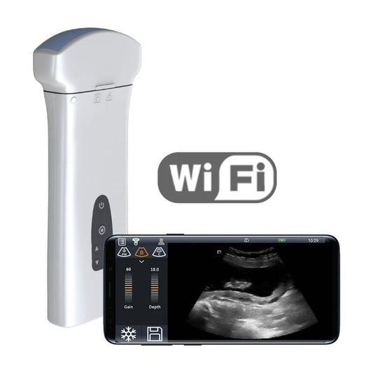 Youkey D8 Mobile Ultrasound Machine color | with convex transducer (C5-2Ks)