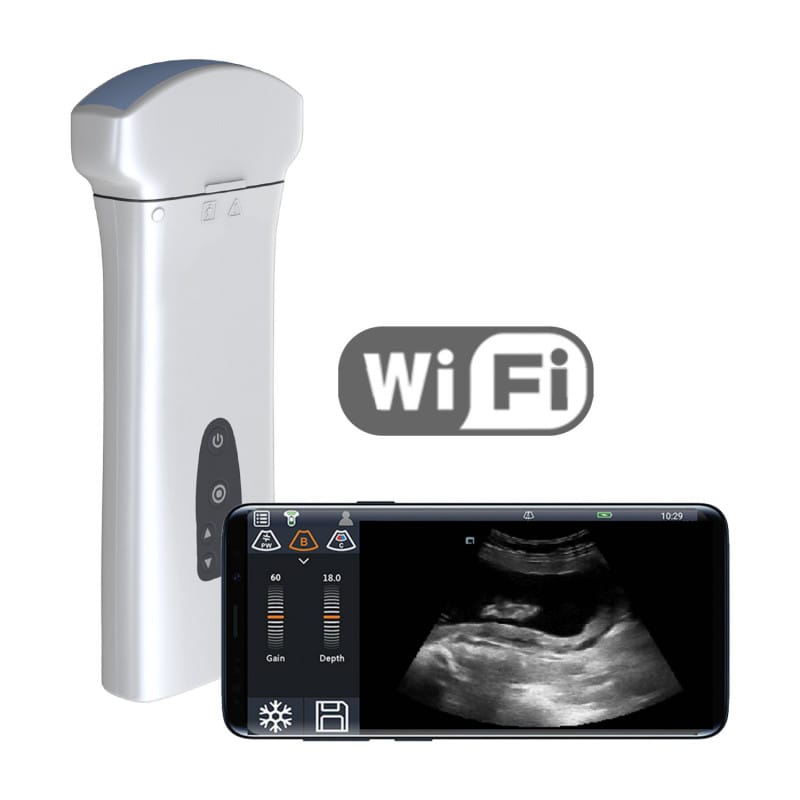 Youkey D8 Mobile Ultrasound Machine color | with linear transducer (L11-4Ks)