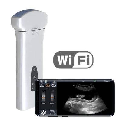 Youkey D8 Mobile Ultrasound Machine color | with linear transducer (L11-4Ks)