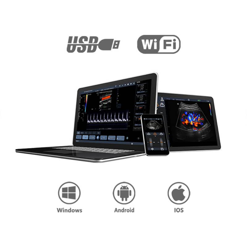 Youkey D8 Mobile Ultrasound Machine color | with linear transducer (L11-4Gs)
