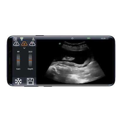 Youkey D8 Mobile Ultrasound Machine color | with linear transducer (L11-4Ks)