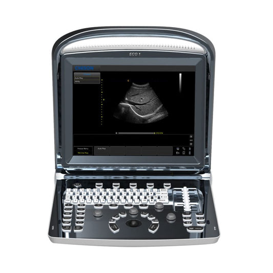 Chison ECO 1 Ultrasound Machine with rechargeable battery | convex transducer (C3-A)