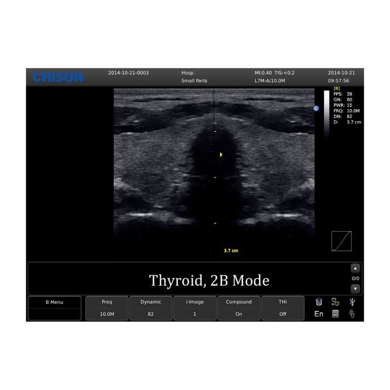 Chison ECO 1 Ultrasound Machine without rechargeable battery | linear transducer (L7M-A)