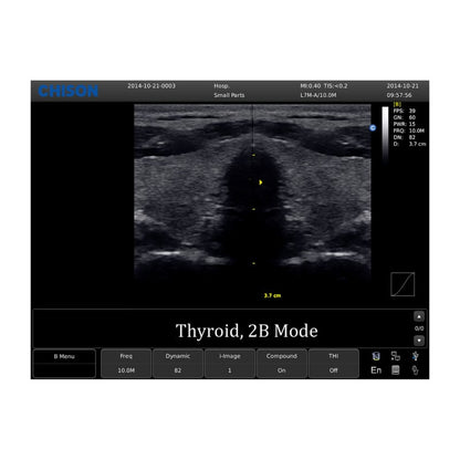 Chison ECO 1 Ultrasound Machine without rechargeable battery | linear transducer (L7M-A)