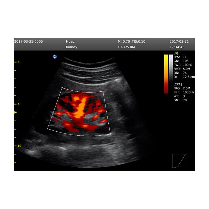 CHISON ECO6 incl. Ultrasound Trolley with linear probe