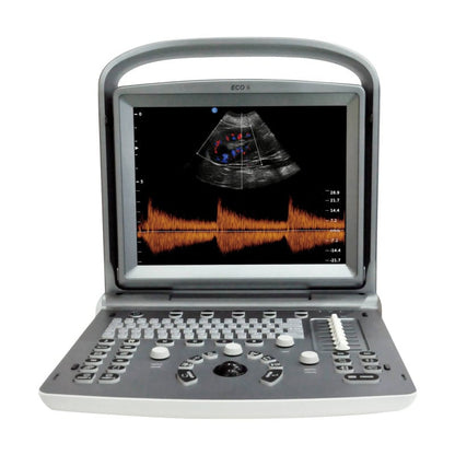 Chison ECO 6 Ultrasound Machine with C3-A convex transducer