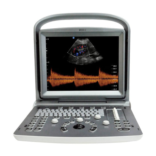 Chison ECO 6 Ultrasound Machine with C3-A convex transducer & P3-A phased array transducer