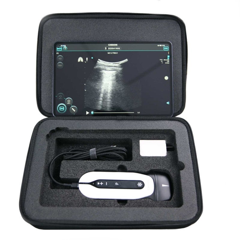 Transport Case for «SonoEye»
