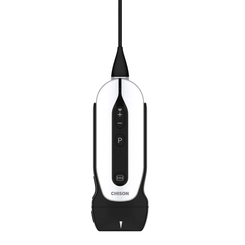 Chison Portable Ultrasound Machine “SonoEye” P3 (with 3.0 MHz phased array transducer)