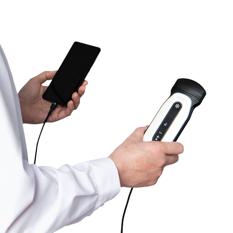 Chison Portable Ultrasound Machine “SonoEye” P2 (with 7.5 MHz linear transducer)