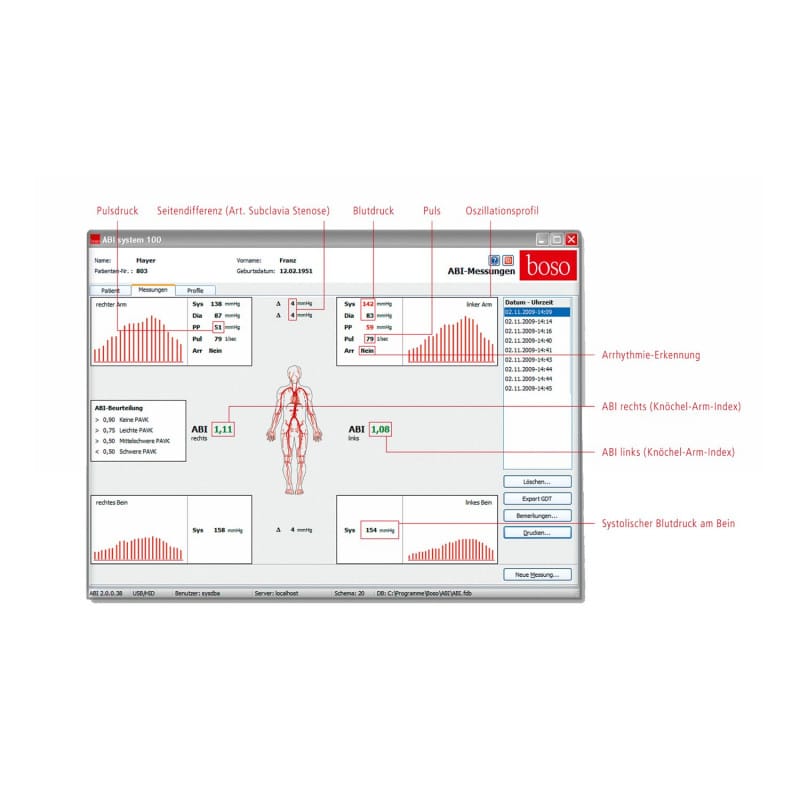 boso ABI System 100 Standard | silver