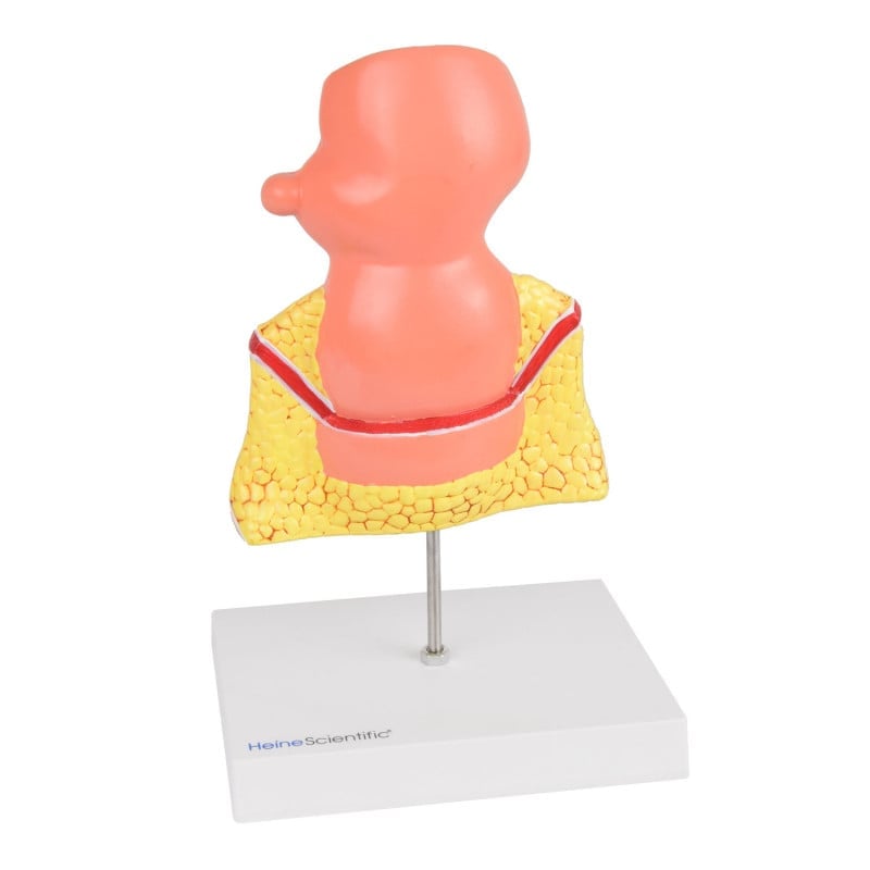 Rectum Model with Pathologies