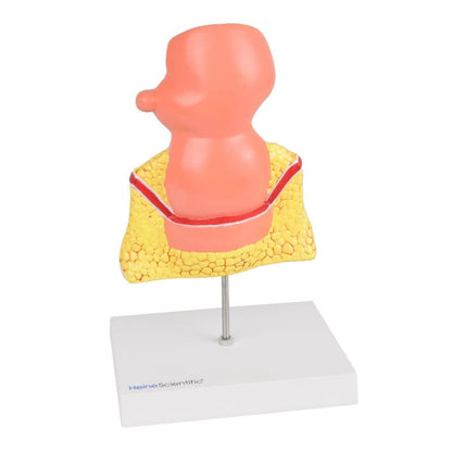 Rectum Model with Pathologies