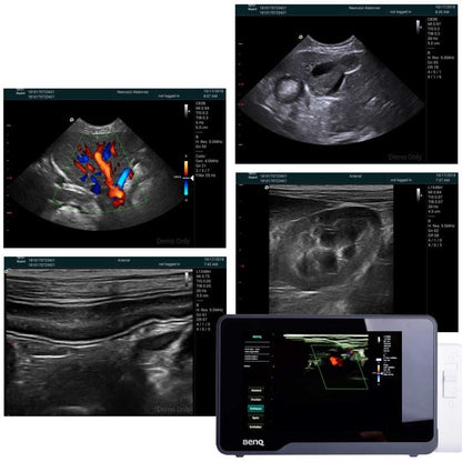 H1300 Portable Ultrasound with linear probe L154BH