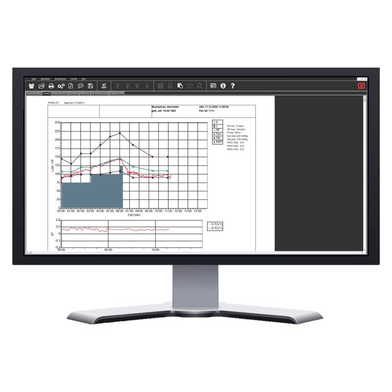 SmartScript Ergometry Special Packet