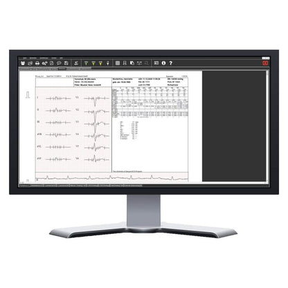 SmartScript Ergometry Special Packet