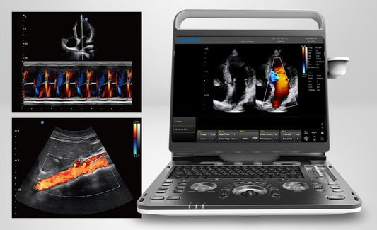 Chison EBit 60 Ultrasound System incl. ultrasound trolley (without height adjustment)