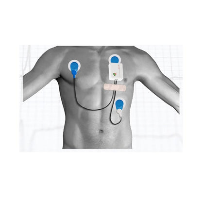 Kobold II Long-term ECG Referral Package