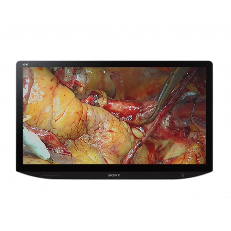 SONY Monitor LMD-X310MT