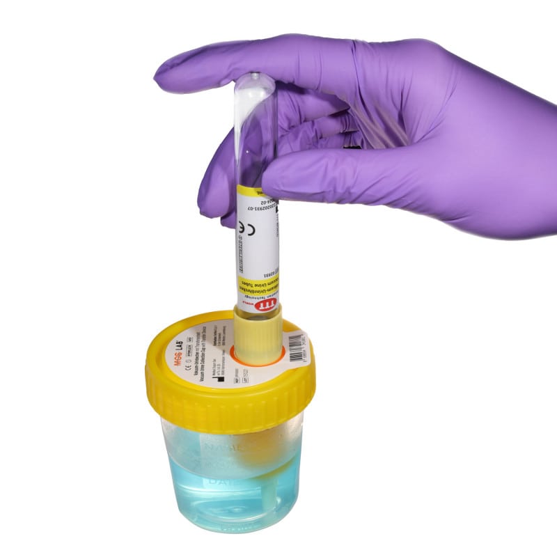 Urine Cup with Transfer Unit
