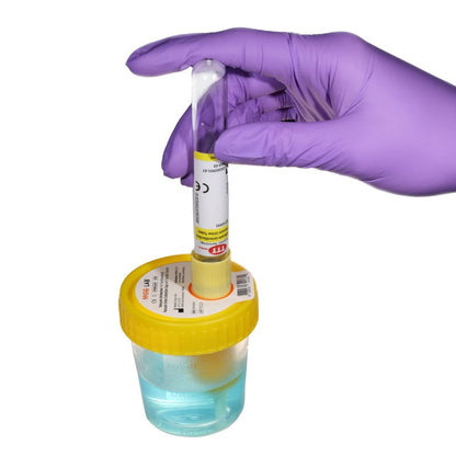 Urine Cup with Transfer Unit