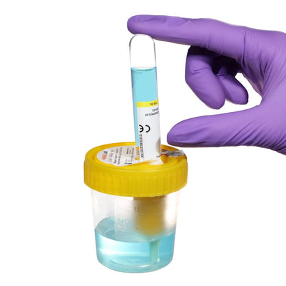 Urine Cup with Transfer Unit