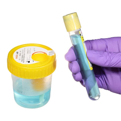 Urine Cup with Transfer Unit