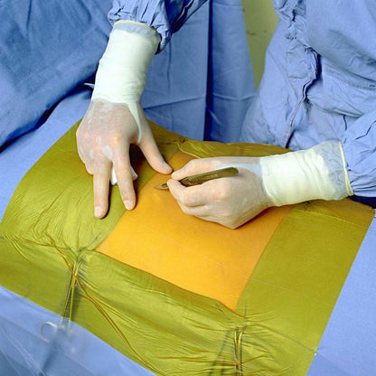 3M™ Ioban™ 2 Antimicrobial Incise Drape 56 x 60 cm