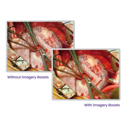 BenQ 21.5" Full HD Surgical Display