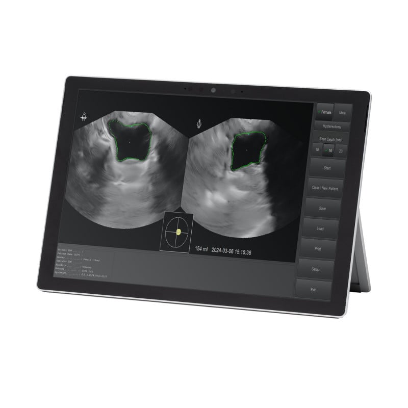 Vitascan LT Bladder Scanner with Chuwi Tablet